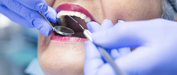 Best Broken or Cracked Tooth Emergency Dentist in Stockton, KS
